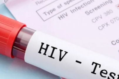 Sağlık Bakanlığı'ndan HIV nedeniyle ölen 13 yaşındaki çocukla ilgili açıklama